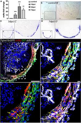 Midkine-a Regulates the Formation of a Fibrotic Scar During Zebrafish Heart Regeneration